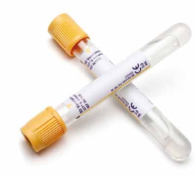 BD Vacutainer® SST™ II Advance 5 ml (plastový uzávěr) — BD Speciální zkumavky, REF 367955